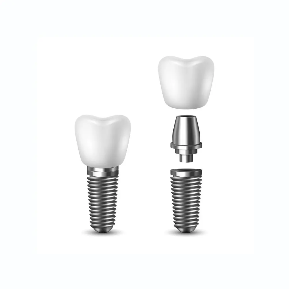 single dental implant model